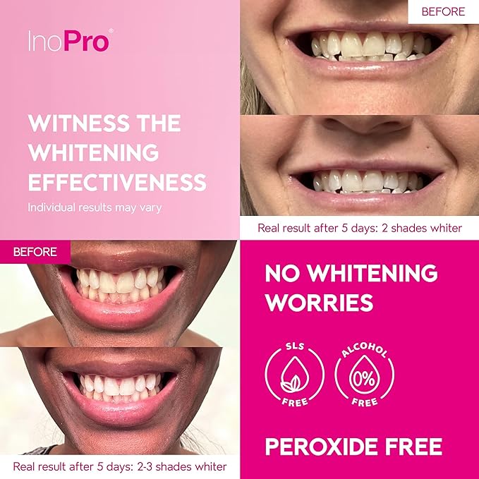 Teeth Whitening Strips